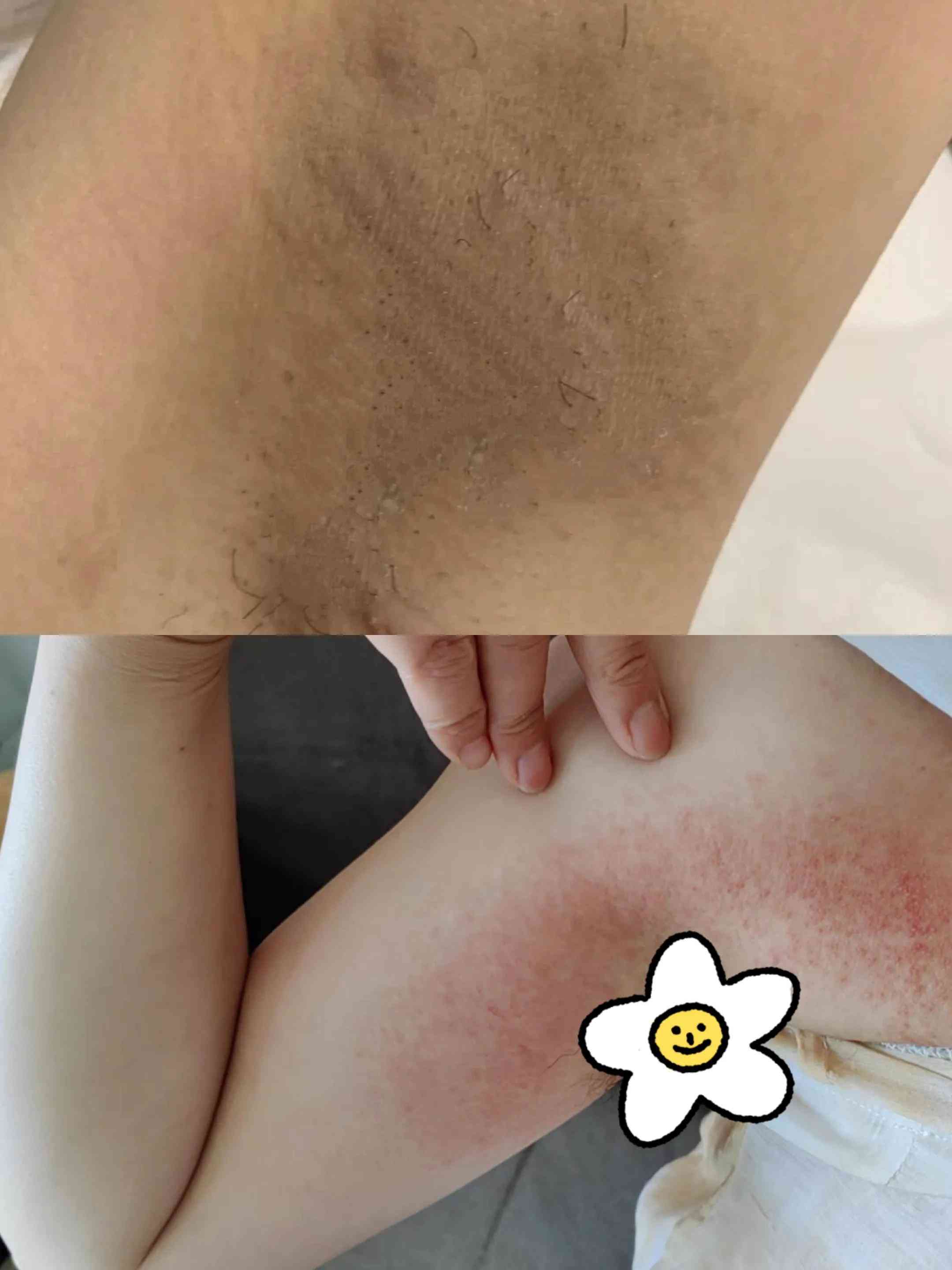 鼻頭出汗化妝品推薦女(鼻頭容易出汗是什么皮膚)