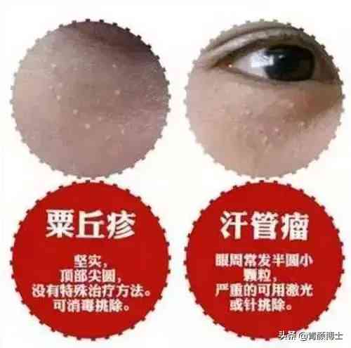 眼霜屬化妝品嗎(眼霜屬于日用品嗎)插圖5