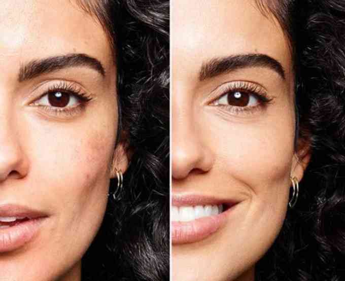 瑕疵皮大毛孔化妝品能用嗎(瑕疵皮大毛孔化妝品能用嗎女生)