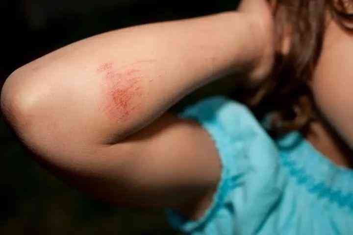 良心國貨化妝品消疤(國貨祛疤膏)插圖11