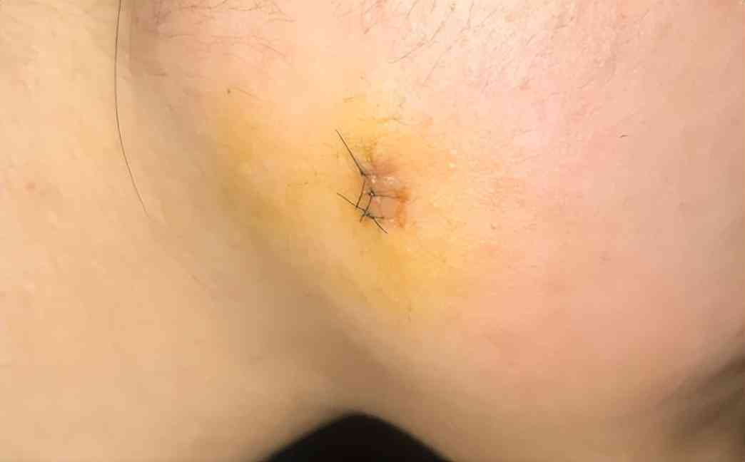 良心國貨化妝品消疤(國貨祛疤膏)插圖12