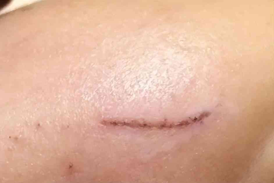 良心國貨化妝品消疤(國貨祛疤膏)插圖13