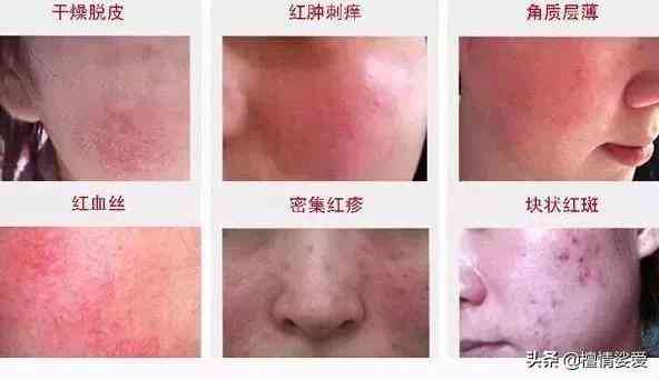 用含激素的化妝品的危害(用含激素的化妝品有什么危害)插圖3