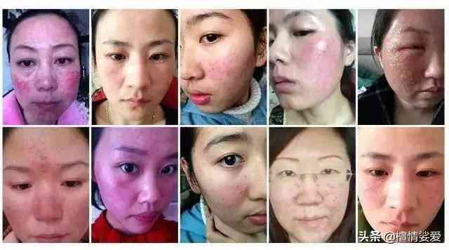 用含激素的化妝品的危害(用含激素的化妝品有什么危害)插圖7