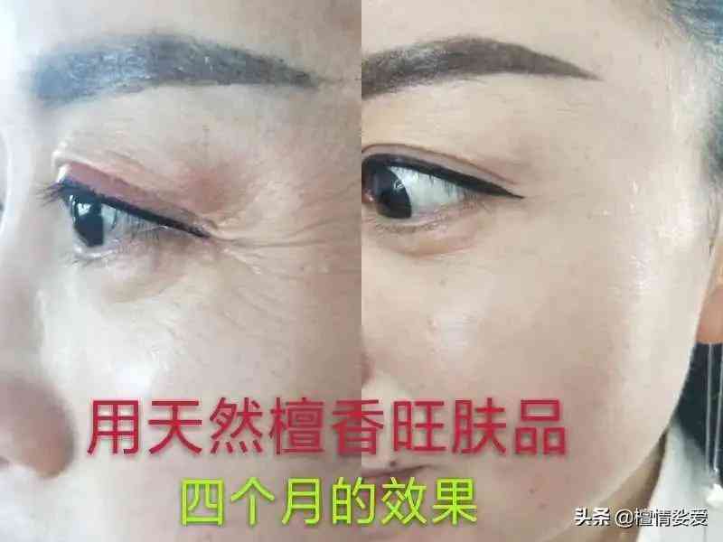 用含激素的化妝品的危害(用含激素的化妝品有什么危害)插圖11