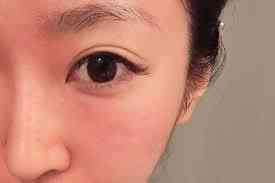 乳酸鋅化妝品(乳酸鋅是什么)插圖1