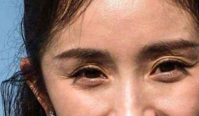 乳酸鋅化妝品(乳酸鋅是什么)插圖5