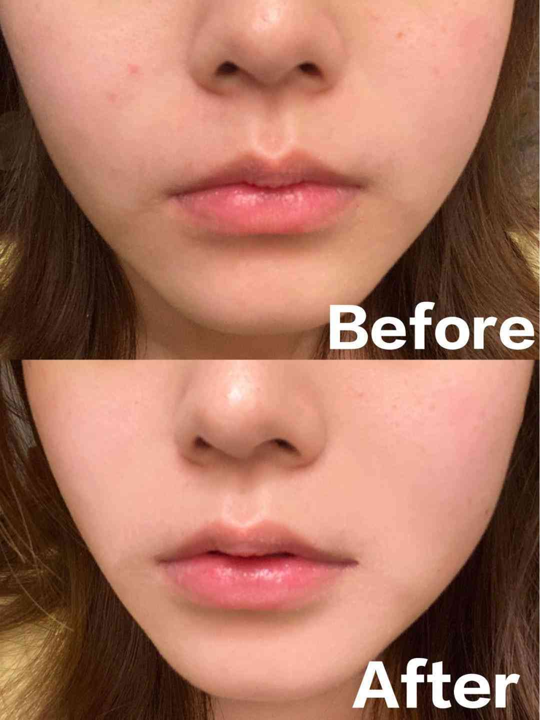 乳酸鋅化妝品(乳酸鋅是什么)插圖25