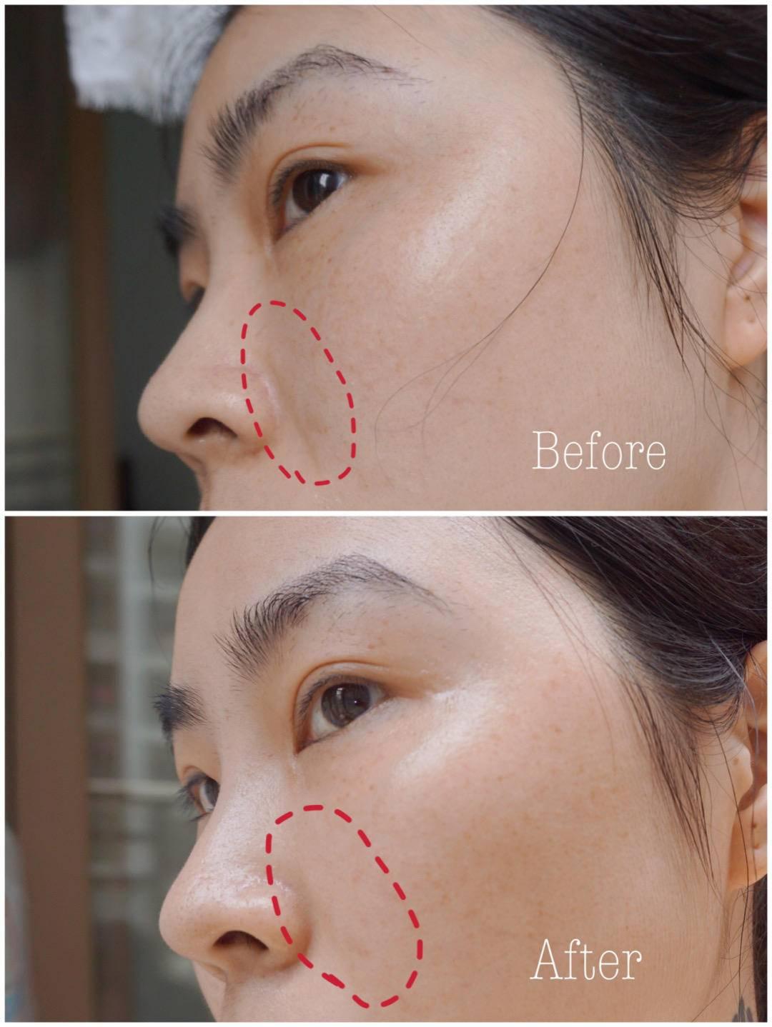 乳酸鋅化妝品(乳酸鋅是什么)插圖28