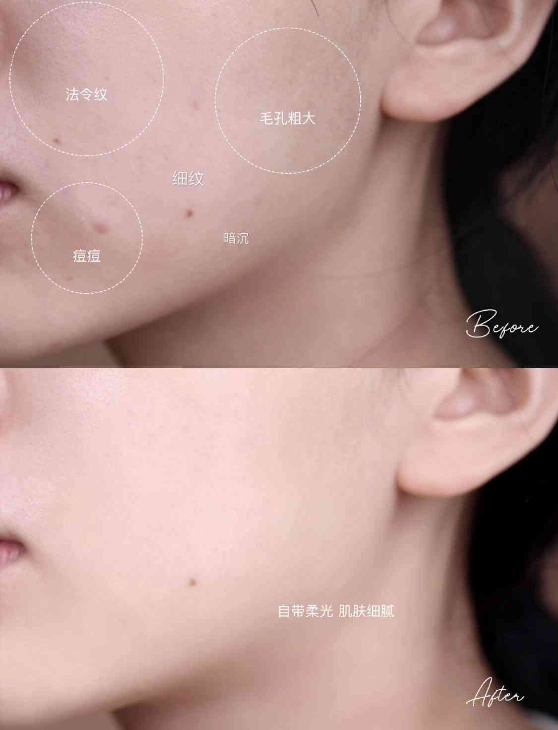 乳酸鋅化妝品(乳酸鋅是什么)插圖34