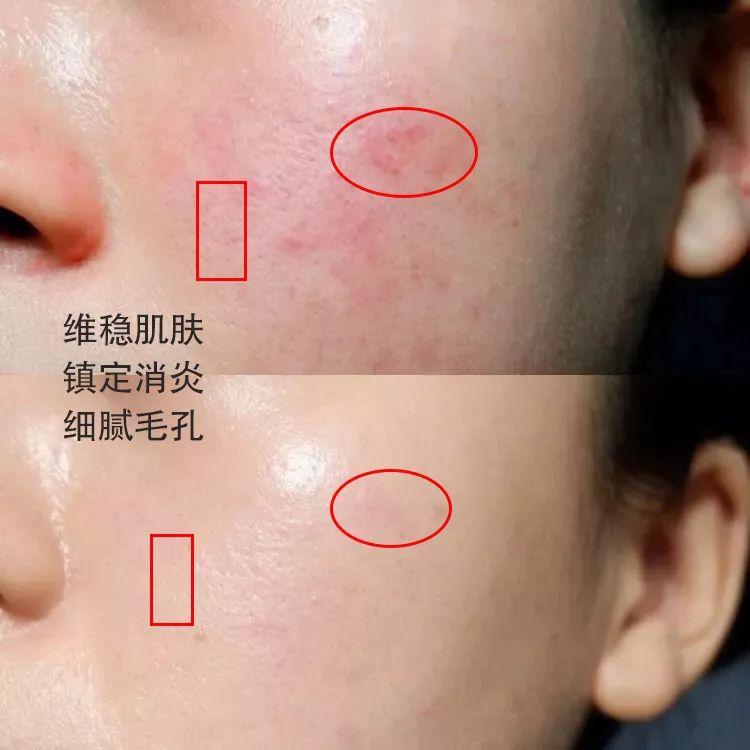 林依晨化妝品分析(林依晨妝容)插圖12