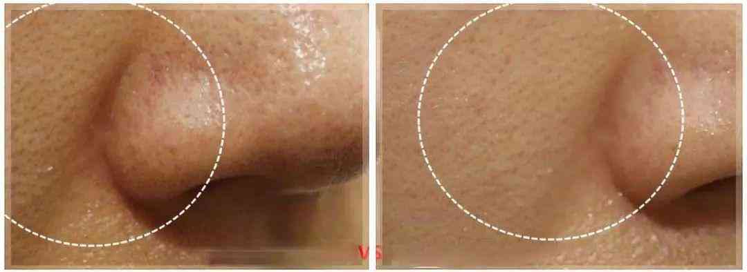 林依晨化妝品分析(林依晨妝容)插圖31