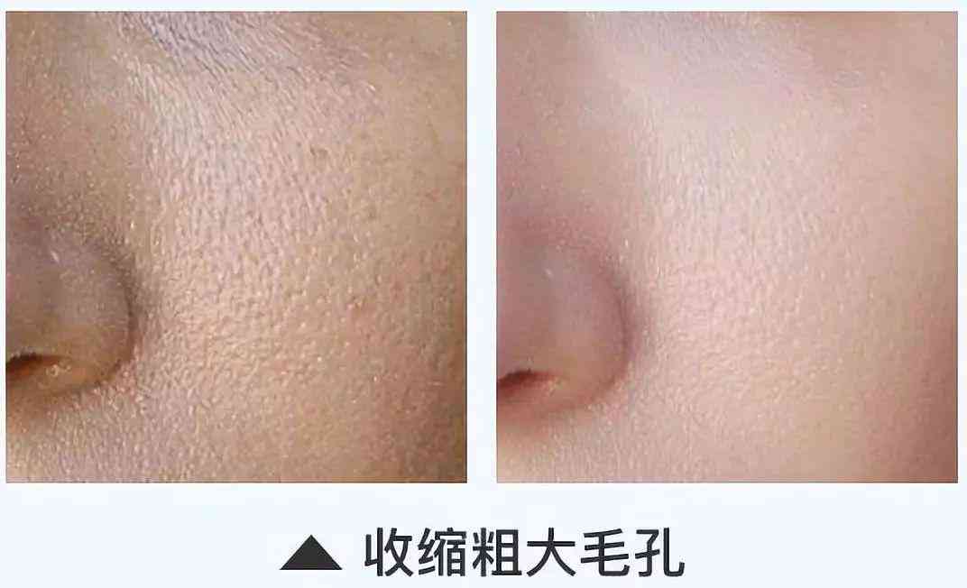 林依晨化妝品分析(林依晨妝容)插圖32