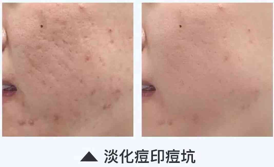 林依晨化妝品分析(林依晨妝容)插圖33