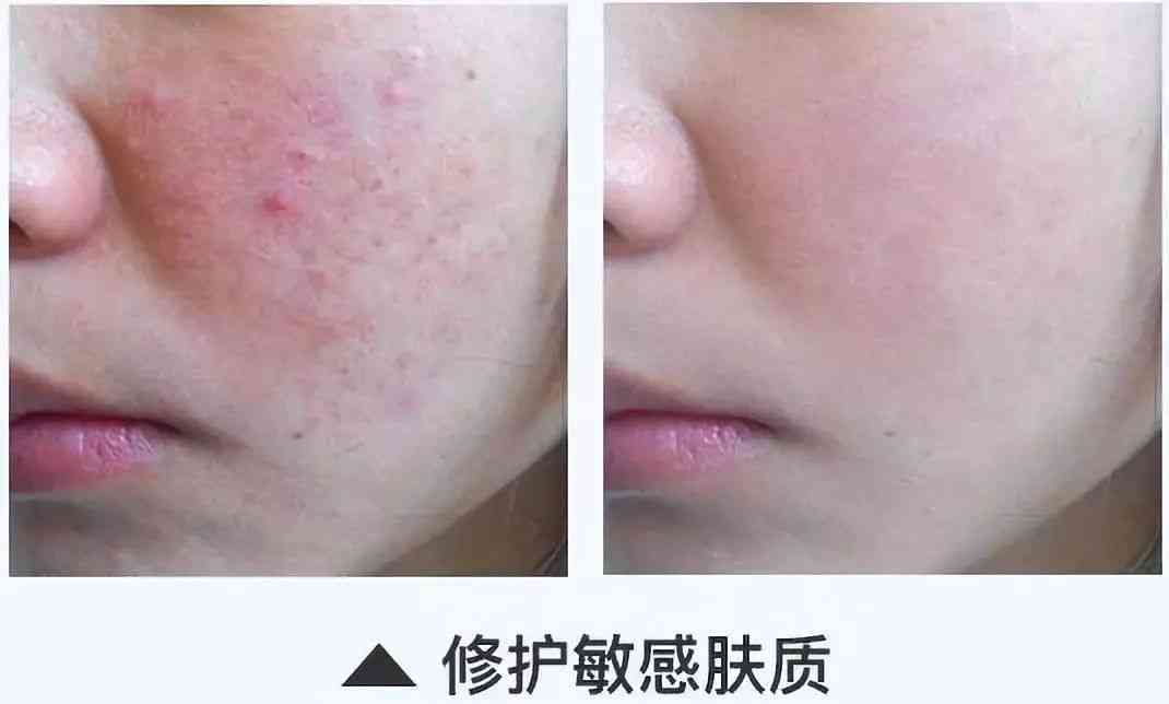 林依晨化妝品分析(林依晨妝容)插圖34