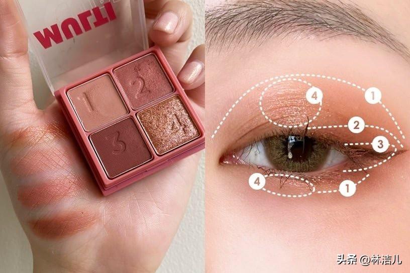 買什么韓國化妝品(白內(nèi)障的早期眼球圖片)插圖6