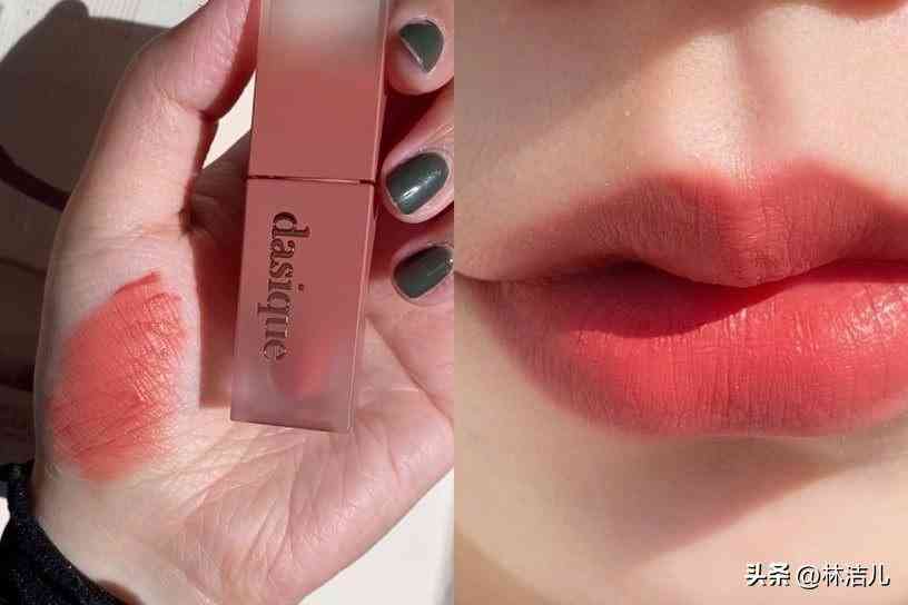 買什么韓國化妝品(白內(nèi)障的早期眼球圖片)插圖11