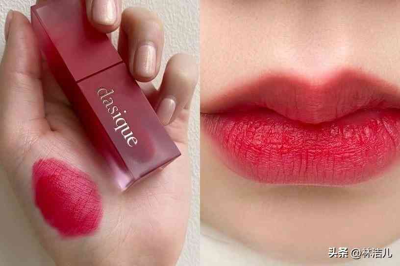 買什么韓國化妝品(白內(nèi)障的早期眼球圖片)插圖12