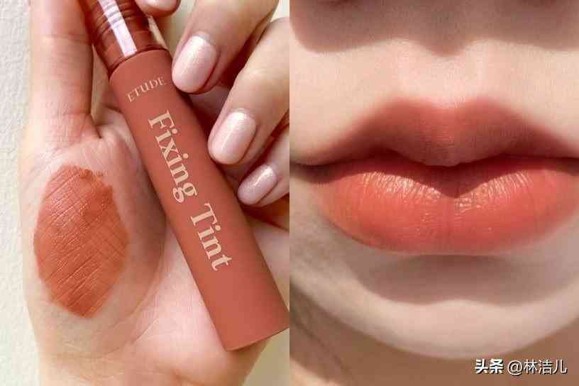 買什么韓國化妝品(白內(nèi)障的早期眼球圖片)插圖14