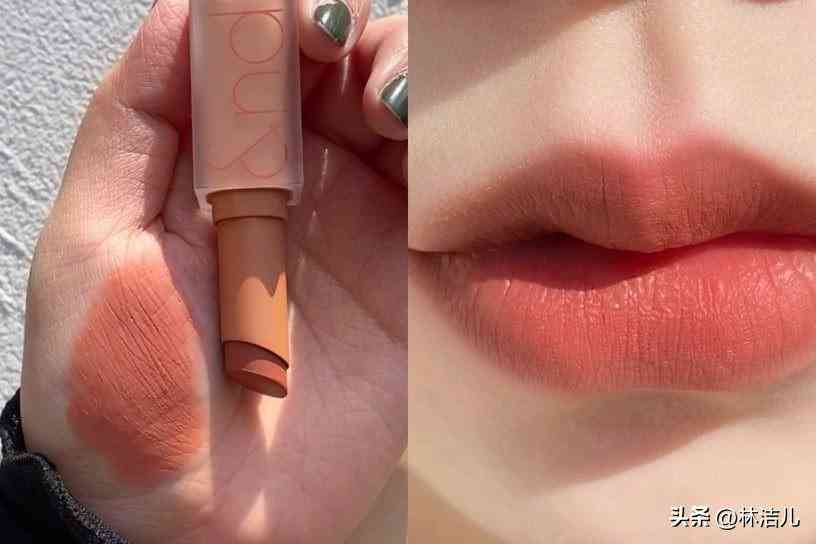 買什么韓國化妝品(白內(nèi)障的早期眼球圖片)插圖16