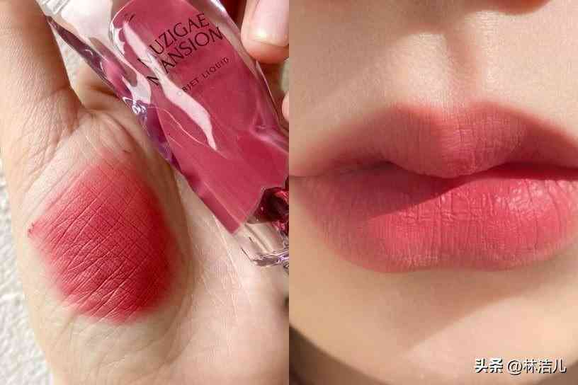 買什么韓國化妝品(白內(nèi)障的早期眼球圖片)插圖18