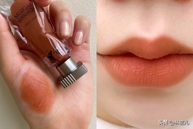 買什么韓國化妝品(白內(nèi)障的早期眼球圖片)插圖19