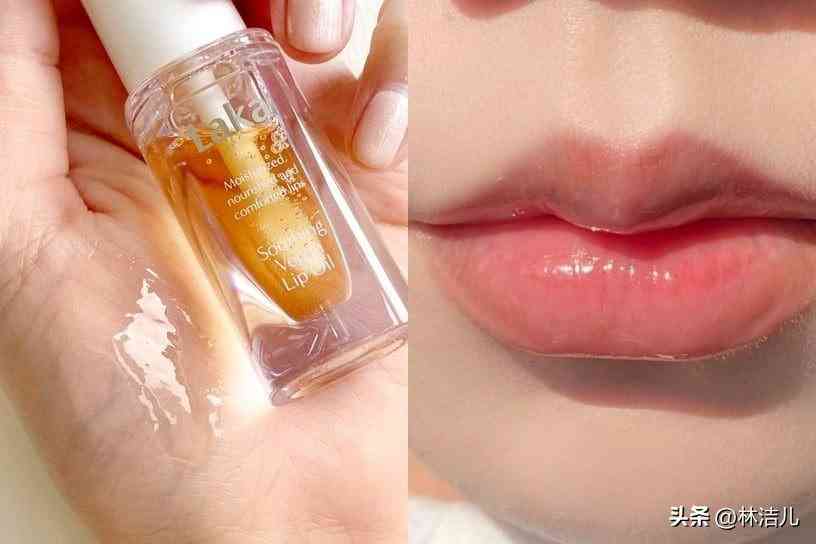 買什么韓國化妝品(白內(nèi)障的早期眼球圖片)插圖21