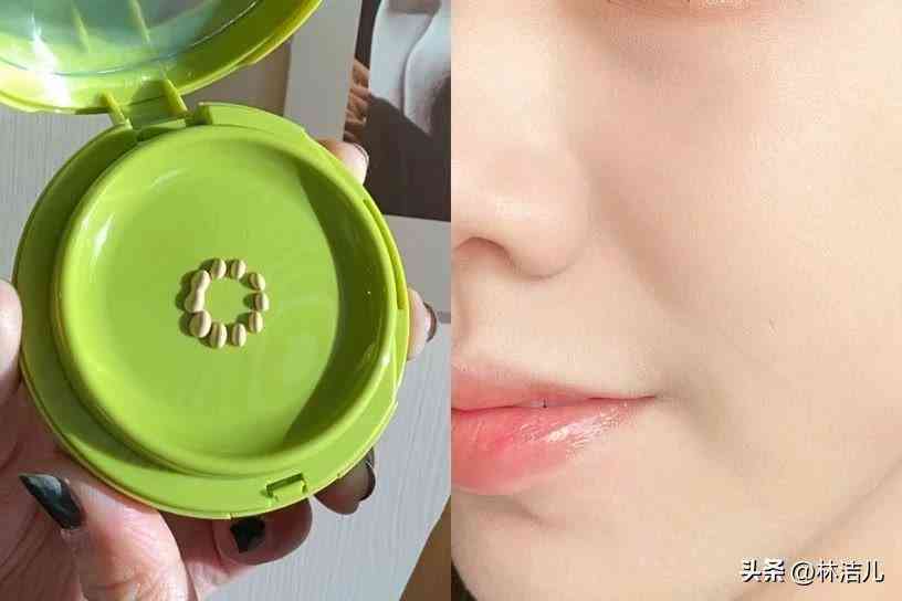 買什么韓國化妝品(白內(nèi)障的早期眼球圖片)插圖23