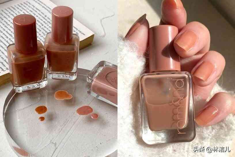 買什么韓國化妝品(白內(nèi)障的早期眼球圖片)插圖25