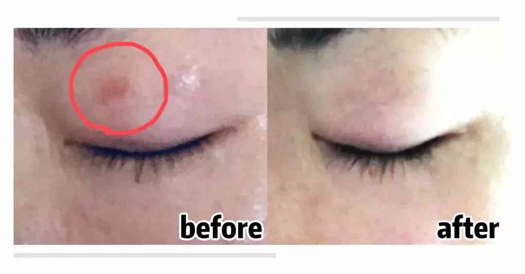 伊索套裝化妝品怎么樣(伊雅索護(hù)膚品怎么樣)插圖7