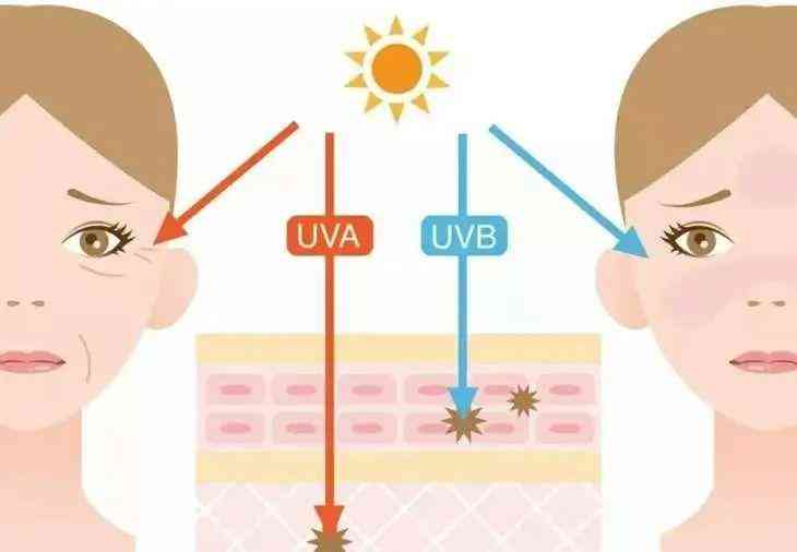 遮掉雀斑的化妝品(遮掉雀斑的化妝品有哪些)