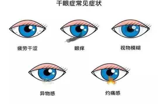 化妝品進(jìn)到眼睛里及時(shí)清洗(清洗劑進(jìn)眼睛了)插圖1