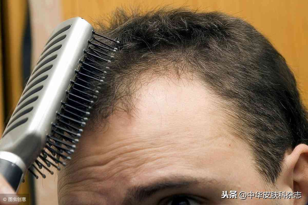 育發(fā)類化妝品的活性成分(什么成分可以育發(fā))插圖1