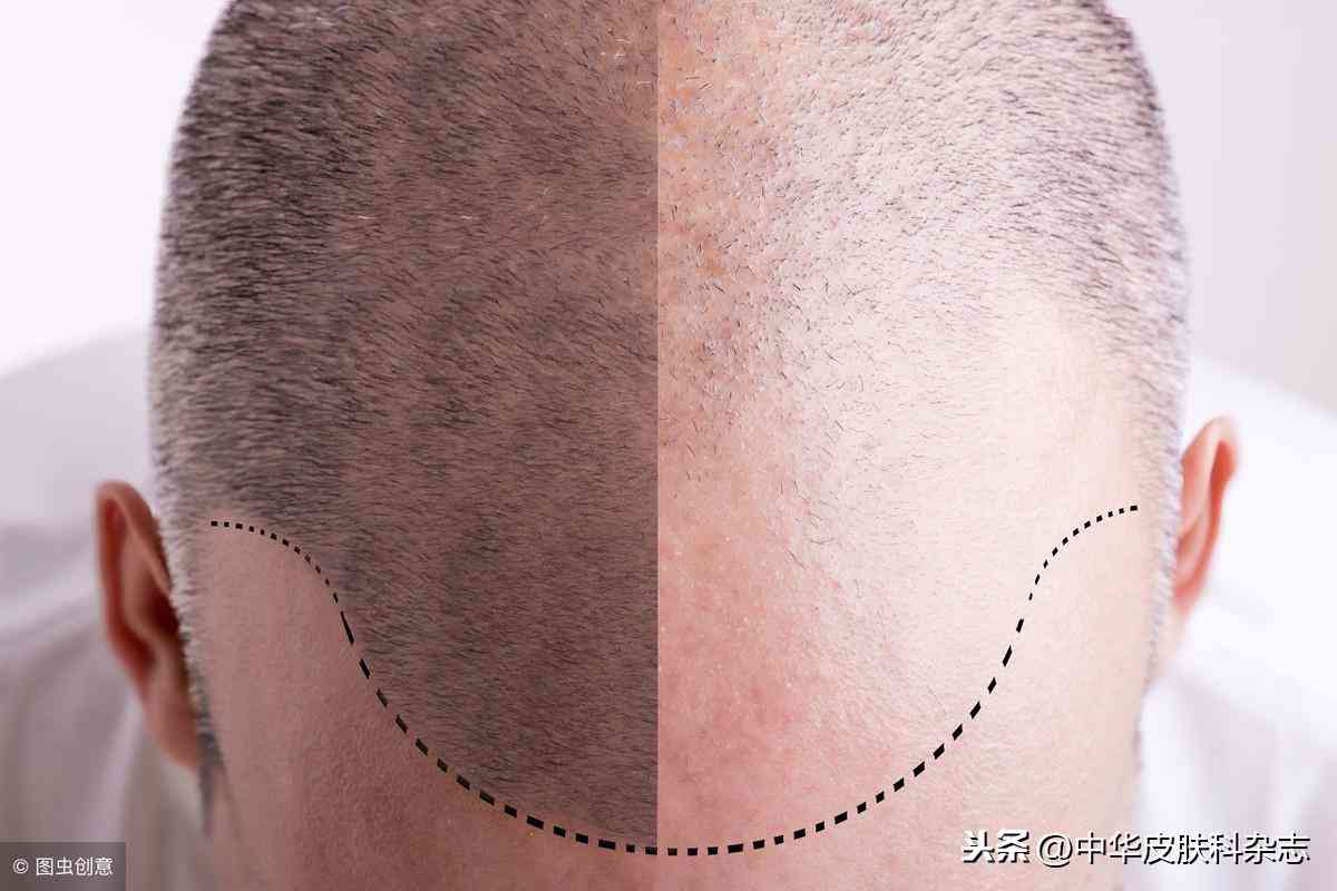 育發(fā)類化妝品的活性成分(什么成分可以育發(fā))插圖4