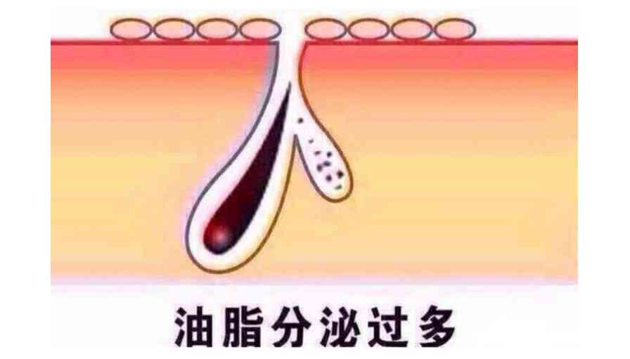 化妝品可以去油脂嗎(油脂的皮膚用什么化妝品好)