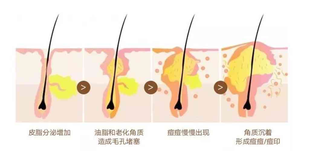 化妝品可以去油脂嗎(油脂的皮膚用什么化妝品好)插圖3