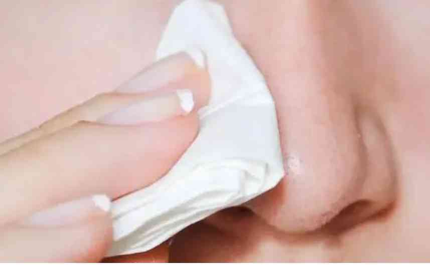 化妝品可以去油脂嗎(油脂的皮膚用什么化妝品好)插圖8