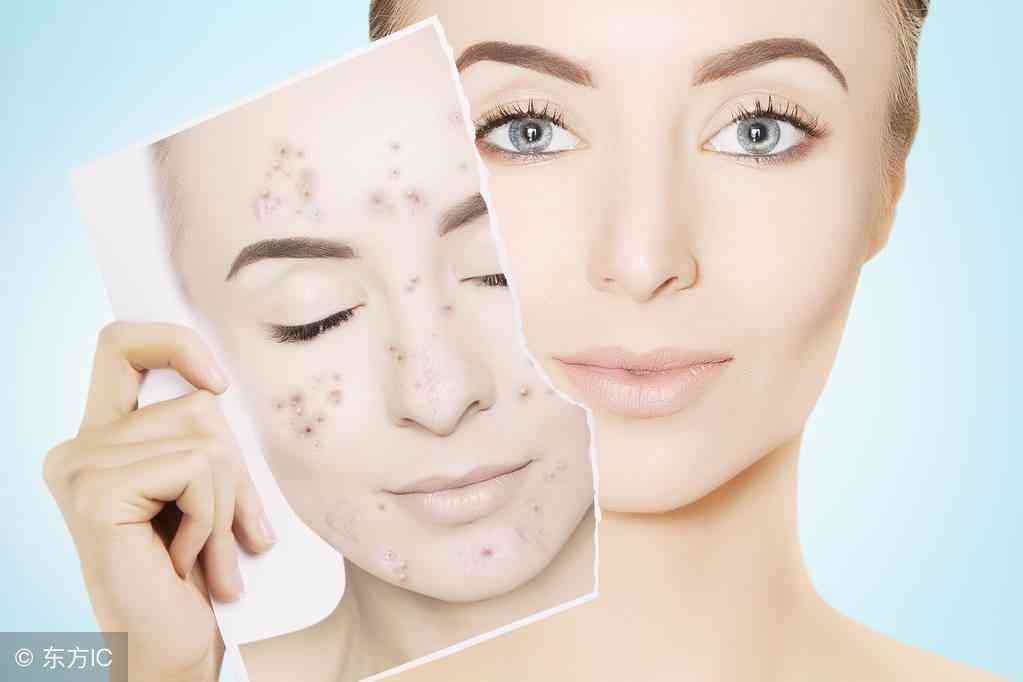 化妝品皮炎吧(化妝品皮炎自己會好嗎)插圖1