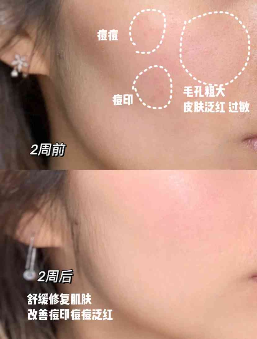 化妝品黑曜石系列(護膚品黑曜石)插圖4