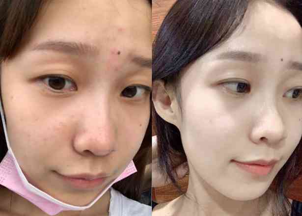 林心如現(xiàn)在用哪品牌化妝品(林心如曾經代言的化妝品品牌)插圖16