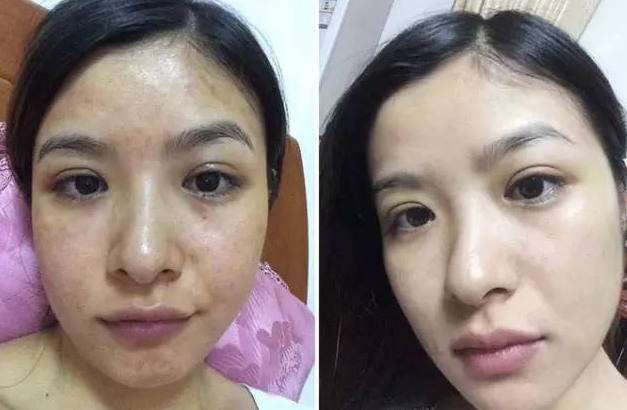 林心如現(xiàn)在用哪品牌化妝品(林心如曾經代言的化妝品品牌)插圖23