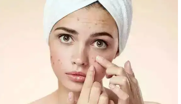 化妝品去痘印效果好(化妝品去痘印效果好的牌子)