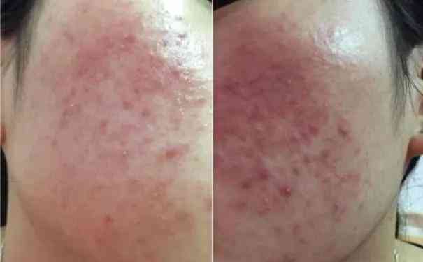 化妝品會(huì)造成臉部浮腫嗎(化妝品會(huì)造成臉部浮腫嗎知乎)