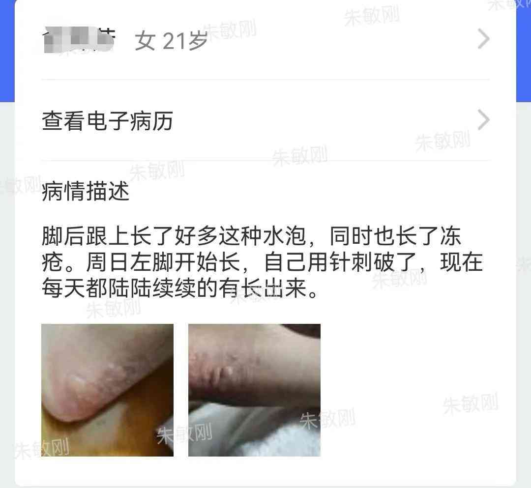 男人用千元化妝品擦腳可以嗎(男人用化妝品有用嗎)