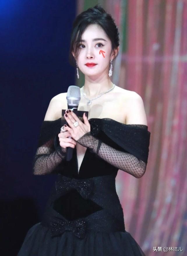 使用化妝品導(dǎo)致長(zhǎng)斑怎么辦(用化妝品之后形成黃褐斑怎么治療)