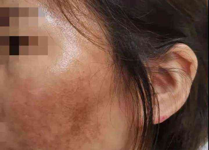 網(wǎng)購化妝品毀容事件(網(wǎng)購化妝品會(huì)傳染新冠病毒嗎)